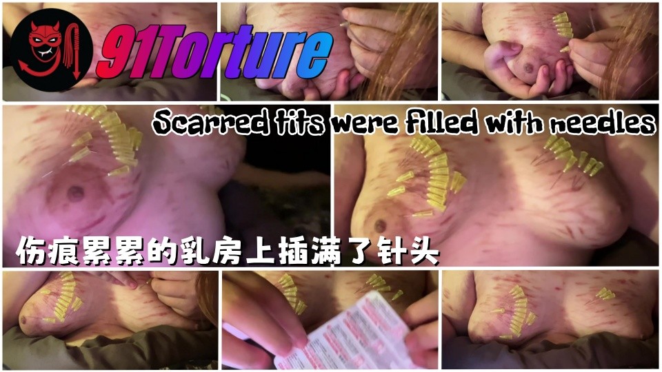 伤痕累累的乳房上插满了针头