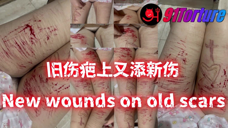 旧伤疤上又添新伤